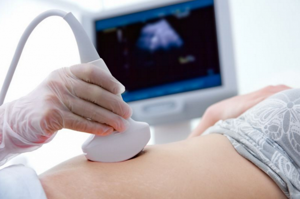 Mẹ bầu cần tuân thủ lịch khám thai định kỳ, đặc biệt ở mốc 12, 22, 32 tuần để phát hiện dị tật thai nhi