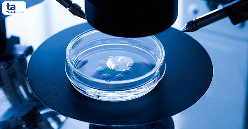 Ghi chép kinh nghiệm 14 ngày sau chuyển phôi