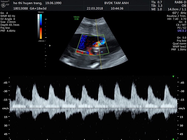 Hinh-3-3537-1522332684