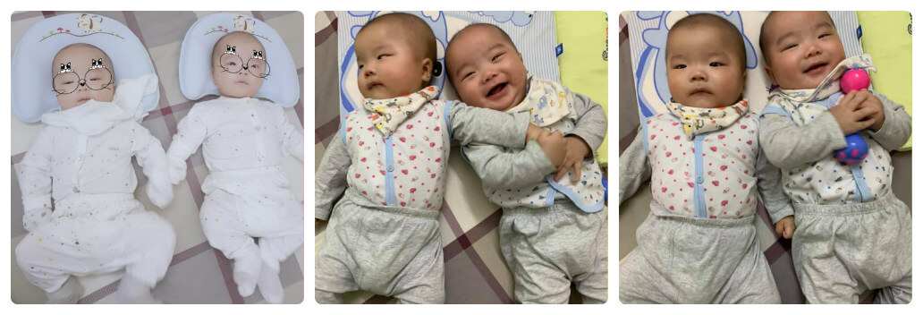 Hai em bé là thành quả của quá trình chạy chữa biến chứng quai bị