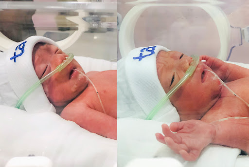 Hai bé trai chào đời với cân nặng 1,5kg và 1,6kg, hoàn toàn khỏe mạnh đang được chăm sóc tại khoa Nhi - Sơ sinh BVĐK Tâm Anh, Hà Nội Hai bé trai chào đời với cân nặng 1,5kg và 1,6kg, hoàn toàn khỏe mạnh đang được chăm sóc tại khoa Nhi - Sơ sinh BVĐK Tâm Anh, Hà Nội