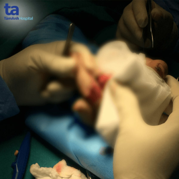 3 ngón tay được hồi sinh