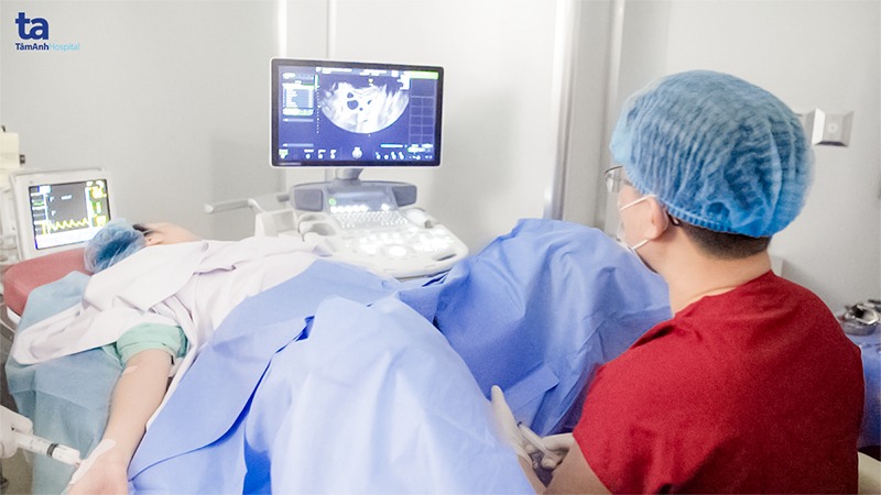 Thực hiện thủ thuật chọc hút noãn cho bệnh nhân