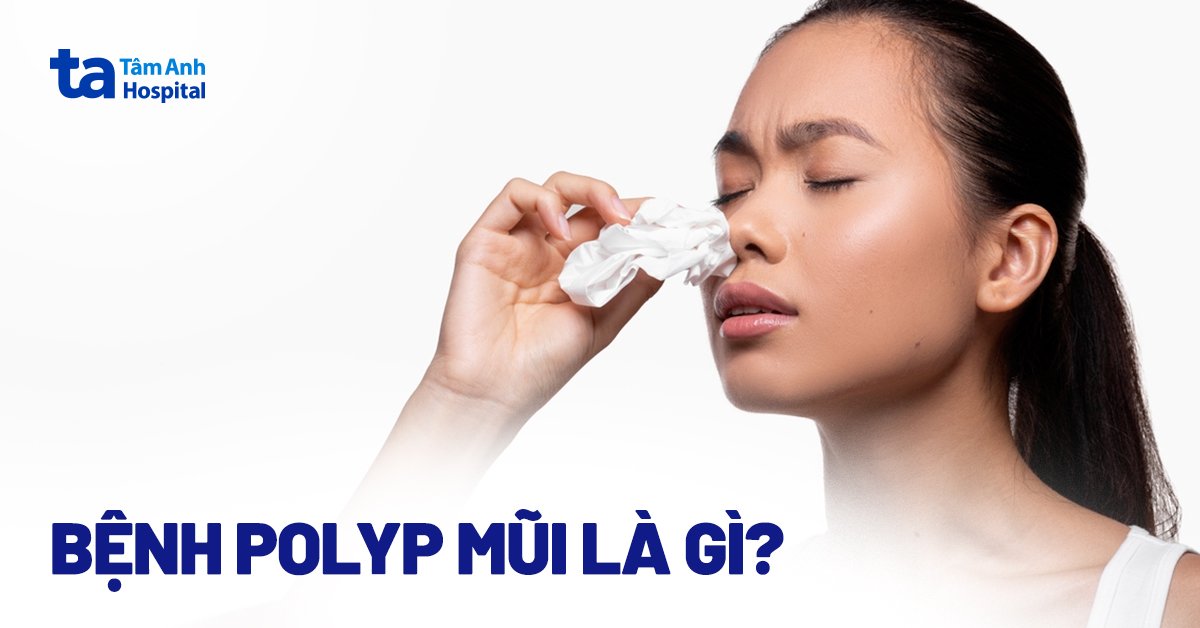 Polyp mũi: 7 nguyên nhân, triệu chứng và cách phòng ngừa