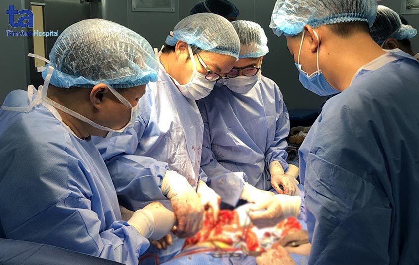 Các bác sĩ Bệnh viện đa khoa Tâm Anh cùng tham gia thực hiện ca phẫu thuật thay khớp và ghép xương cho bệnh nhi ung thư xương