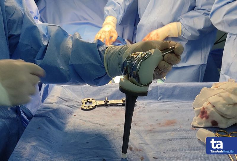 Khớp nhân tạo y sinh PEEK