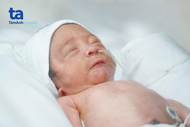 Bé trai chào đời khỏe mạnh ở tuần thai 32 nhờ được bác sĩ Hiền Lê kịp thời phẫu thuật điều trị truyền máu song thai mất sóng doppler ở não