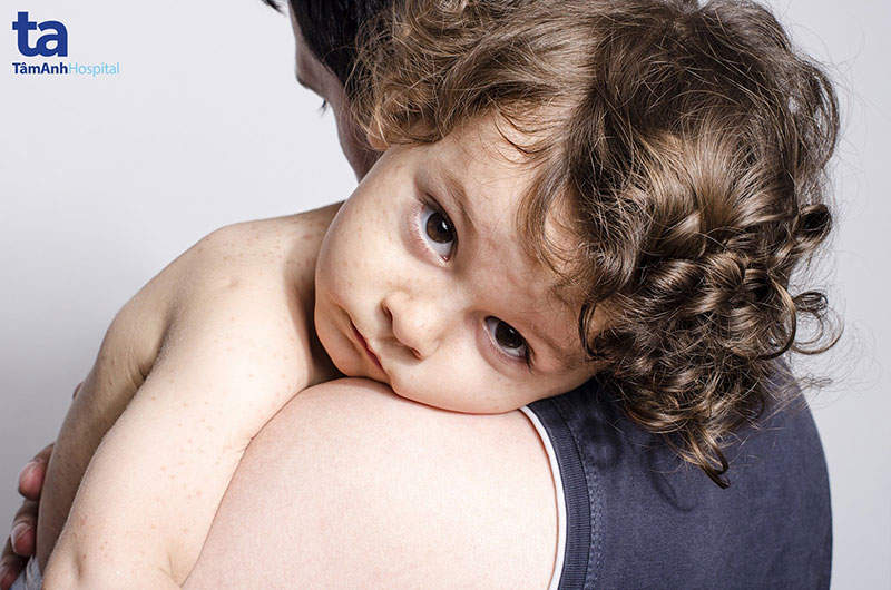 98,7% trường hợp mắc sởi ở trẻ em là chưa từng tiêm hoặc tiêm không đủ mũi vắc xin theo khuyến cáo