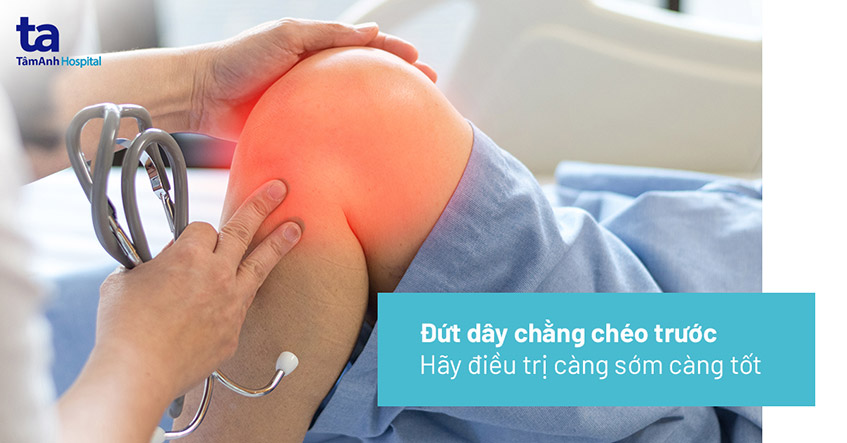 Chấn thương đứt dây chằng chéo trước (ACL): Nguyên nhân, cách trị