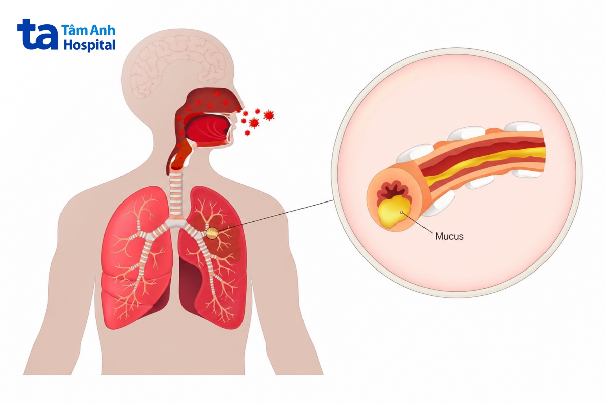 khó thở có thể liên quan đến nhiều bệnh lý