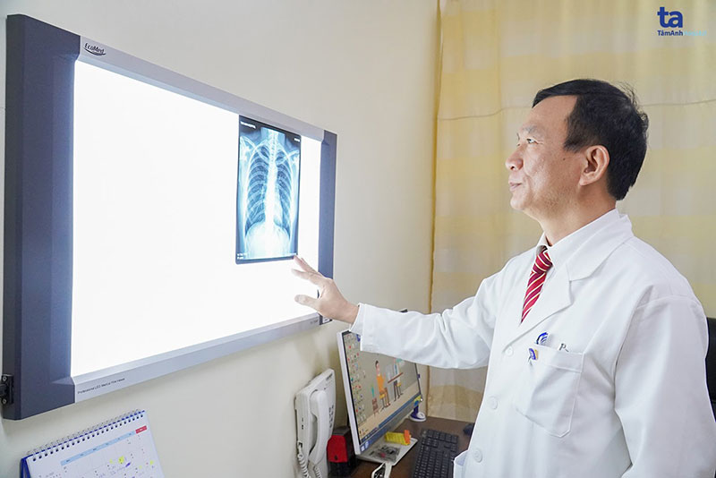 phim chup x quang phoi