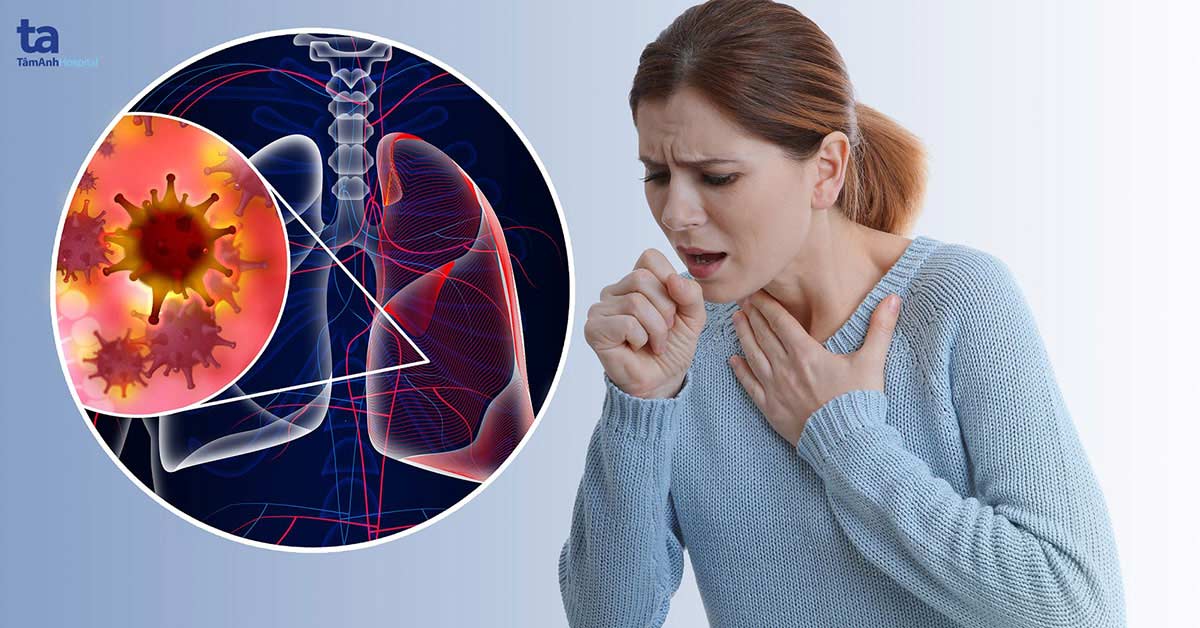 Ung thư phổi (u phổi ác tính): Nguyên nhân, dấu hiệu và điều trị