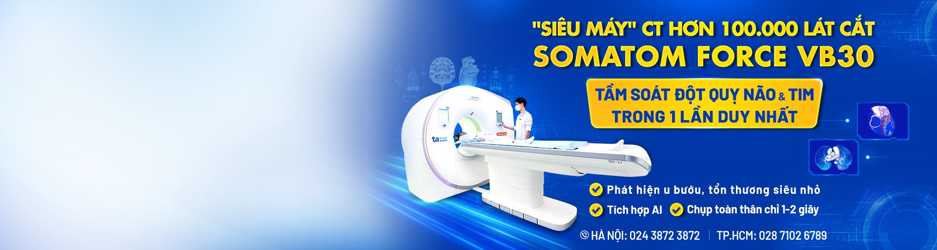 siêu máy CT tầm soát đột quỵ ck