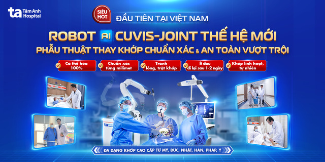 banner mb robot cuvis joint