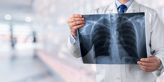 Banner tầm soát ung thư mobile