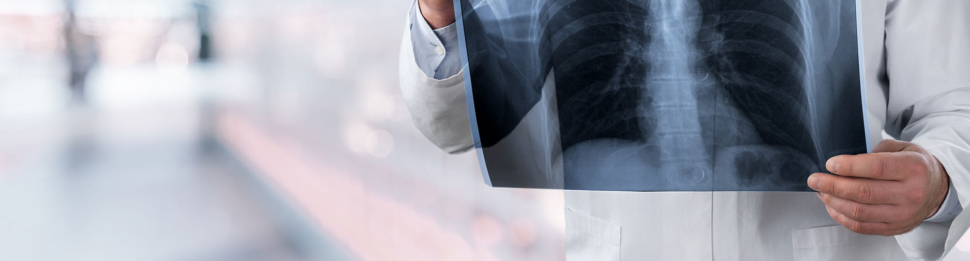 Banner tầm soát ung thư pc