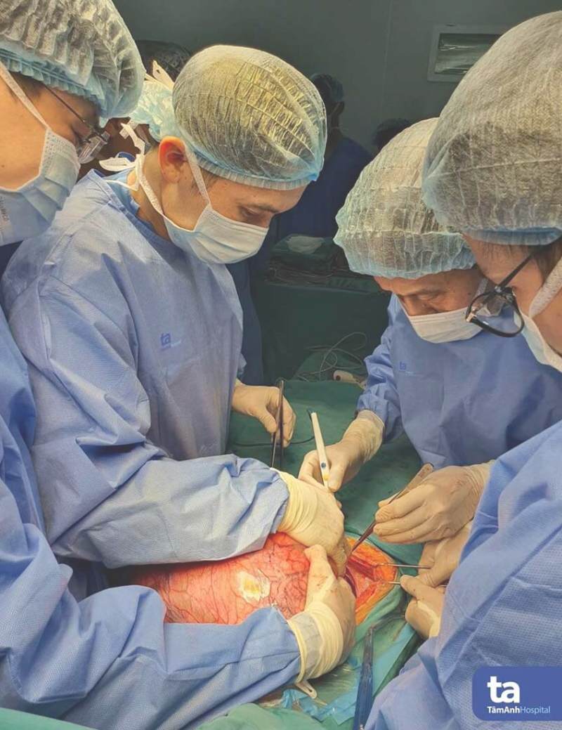 bs bóc u khổng lồ hơn 7kg