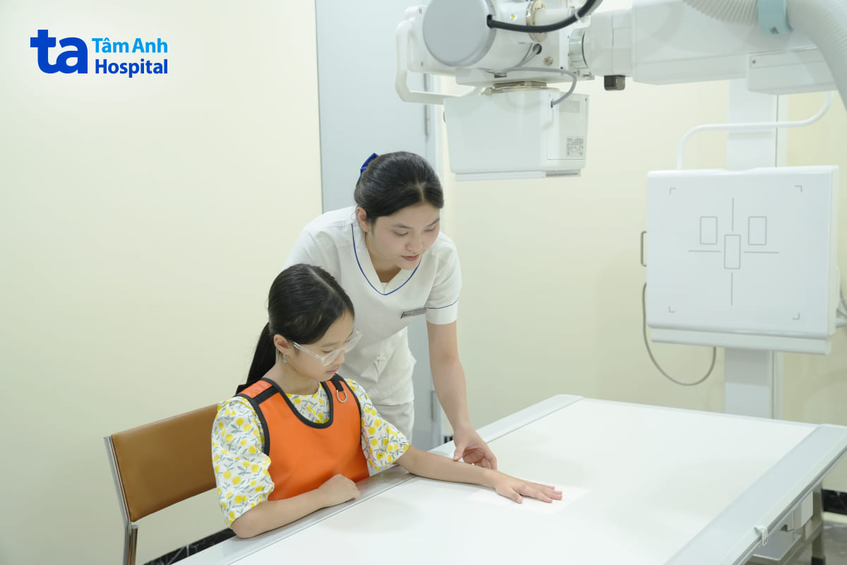 chụp x-quang xương bàn tay và cổ tay trái cho trẻ