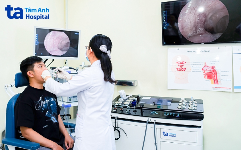máy nội soi Xion Đức