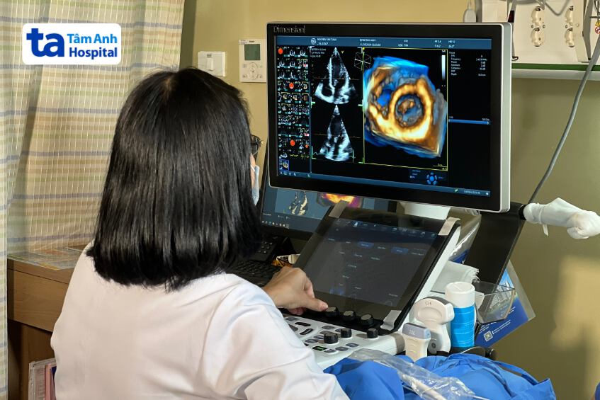 Máy siêu âm tim 4D cao cấp GE Healthcare Vivid S70N Dimension