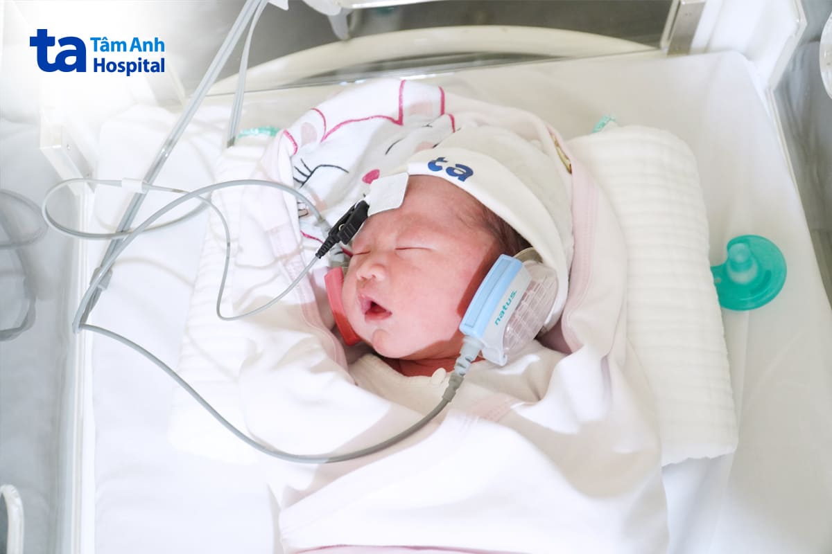 trẻ sơ sinh được sàng lọc bất thường thính lực thông qua máy algo 5® newborn hearing screener