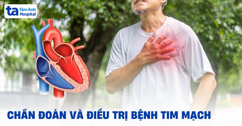 Bệnh tim mạch là gì? Nguyên nhân, chẩn đoán và cách điều trị