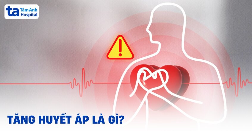 Tăng huyết áp: Triệu chứng, nguyên nhân và chẩn đoán