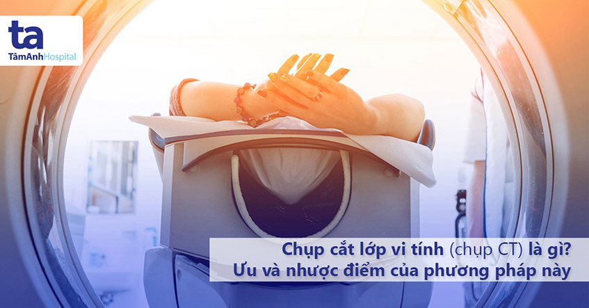 Chụp cắt lớp vi tính (chụp CT): Quy trình, ưu và nhược điểm