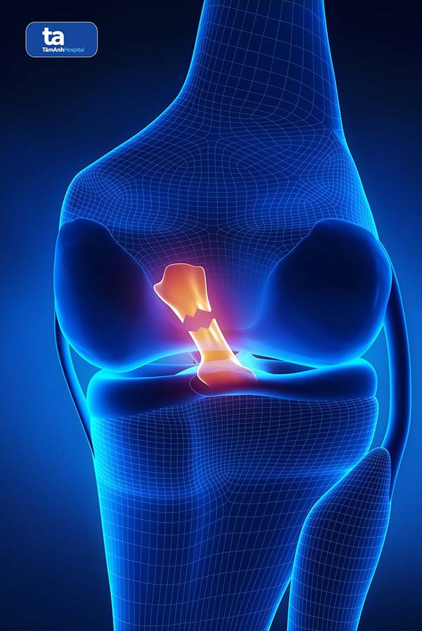 day chang cheo truoc bi dut