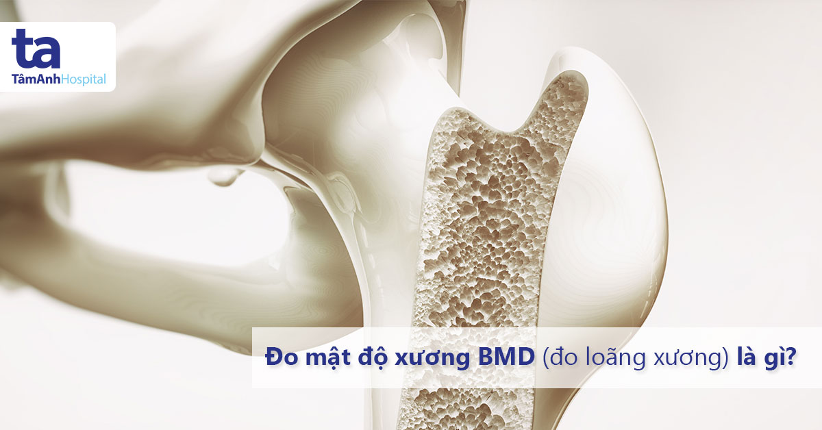 Đo loãng xương (đo mật độ xương BMD) là gì?