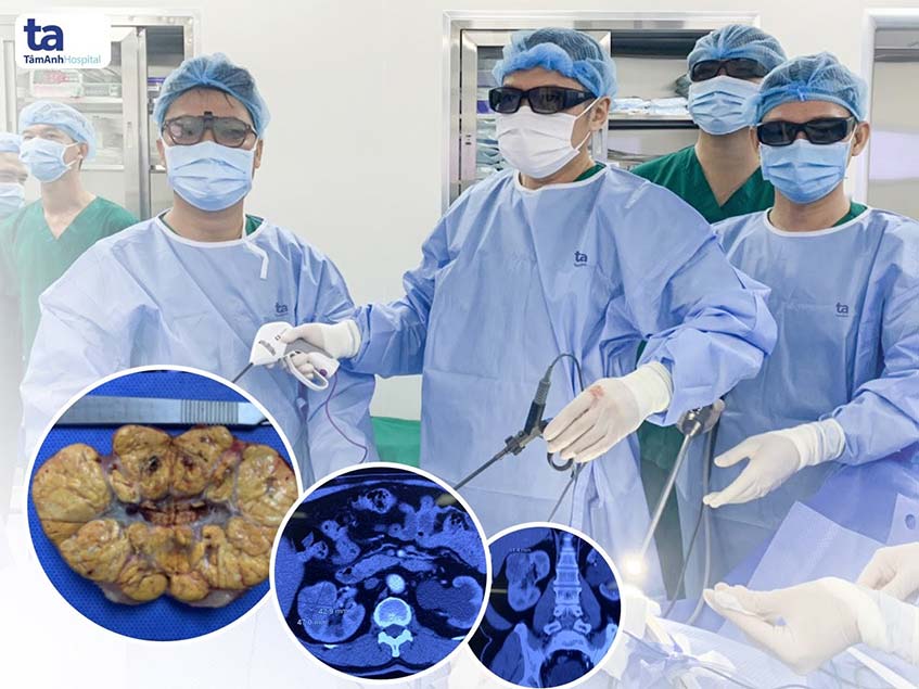 phau thuat noi soi than 3d