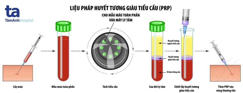 Quy trình sử dụng