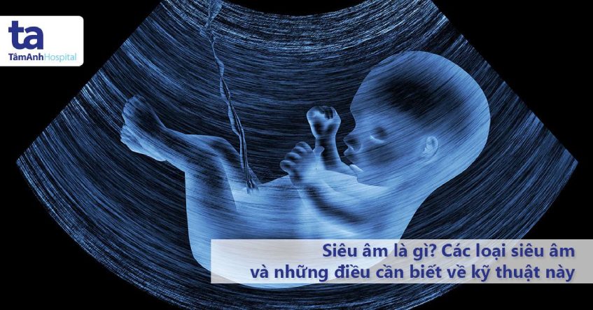 Siêu âm là gì? Quy trình, kỹ thuật và các loại siêu âm phổ biến