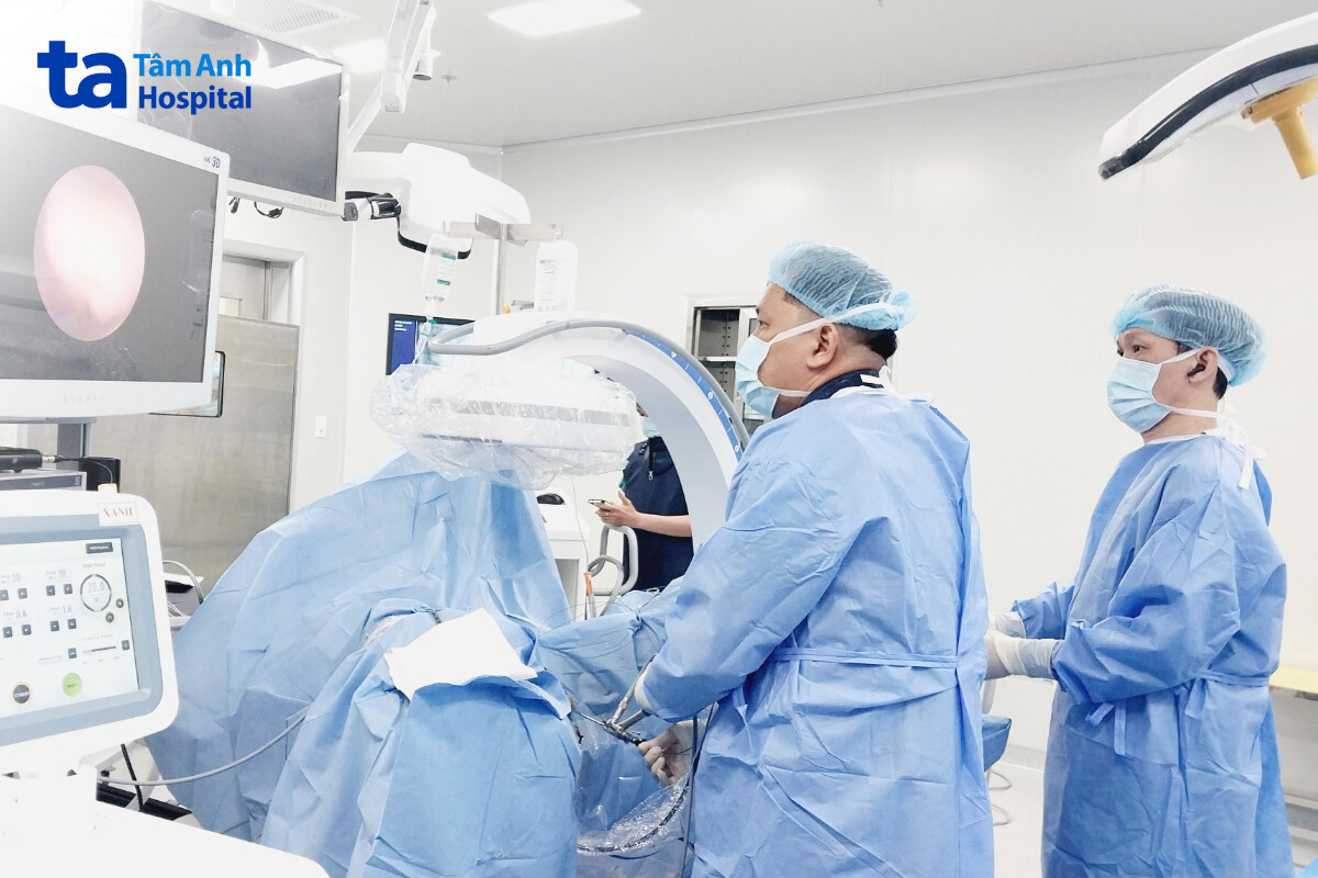 bác sĩ tán sỏi ngược dòng bằng ống mềm
