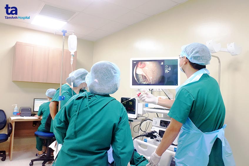 nội soi chẩn đoán ung thư đường tiêu hóa