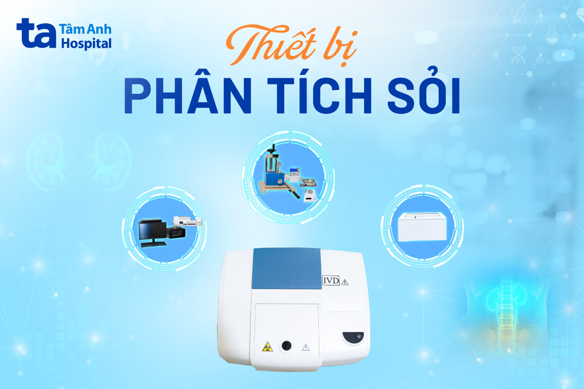 thiết bị phân tích sỏi chính xác cao