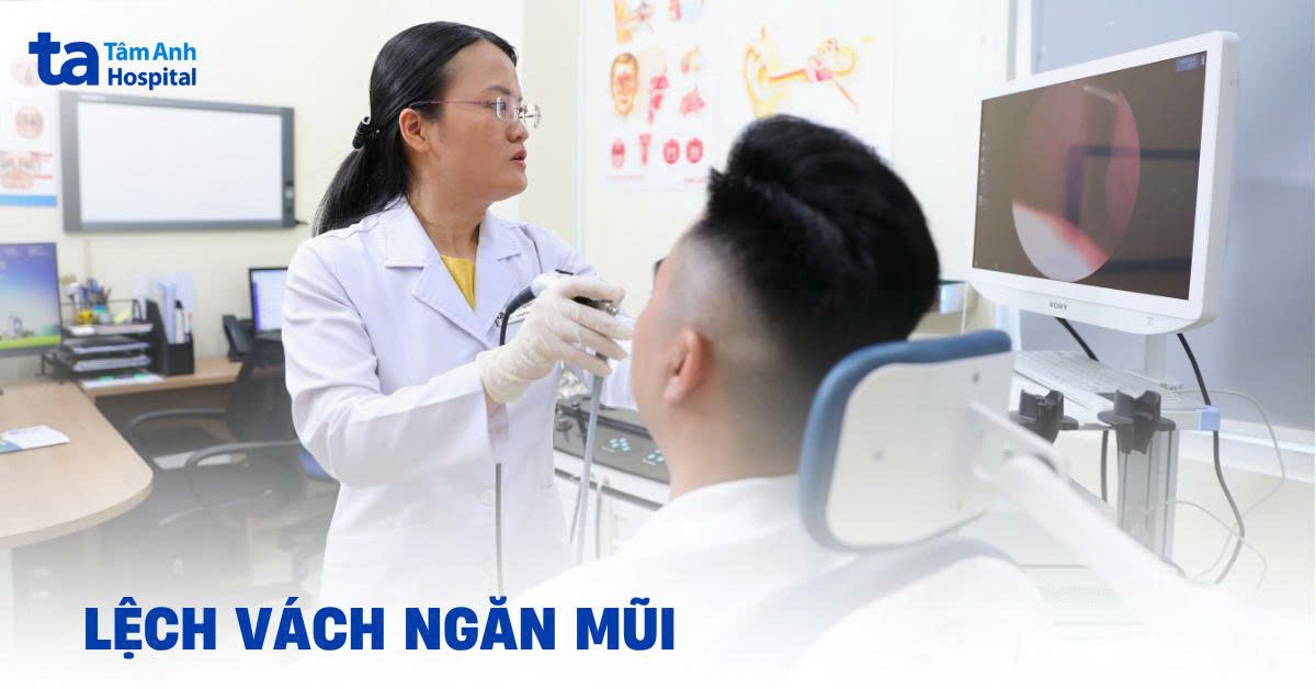 Lệch vách ngăn mũi: Nguyên nhân, dấu hiệu và cách điều trị
