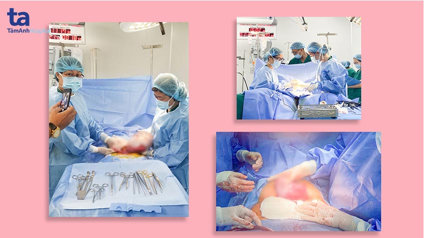 ca sinh mo thanh cong