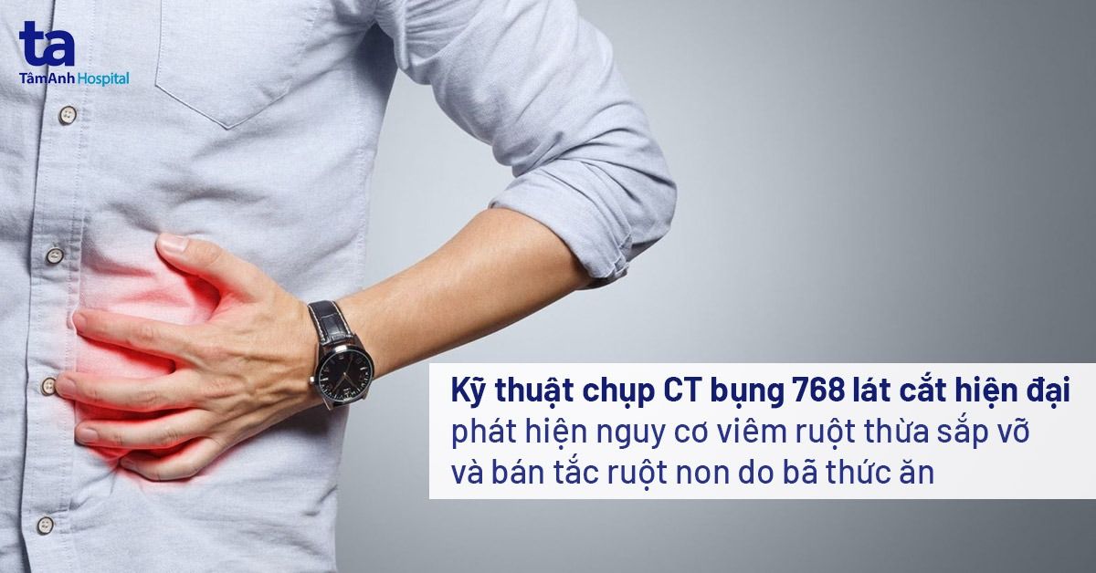 Kỹ thuật chụp CT bụng 768 lát cắt phát hiện nguy cơ viêm ruột thừa