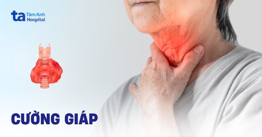 Cường giáp