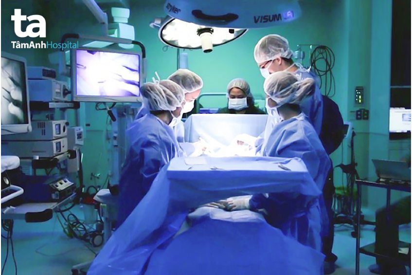 phẫu thuật nội soi ung thư thanh quản