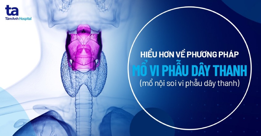Phương pháp mổ vi phẫu dây thanh: Quy trình và ưu nhược điểm