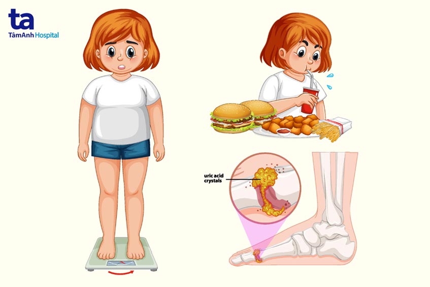 benh gout co lay cho nguoi khac khong