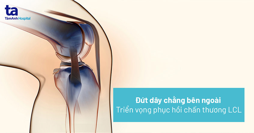 Đứt dây chằng bên ngoài: Nguyên nhân, dấu hiệu và cách điều trị