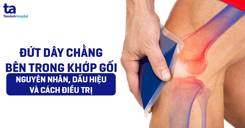 Đứt dây chằng bên trong: Nguyên nhân, dấu hiệu và cách điều trị