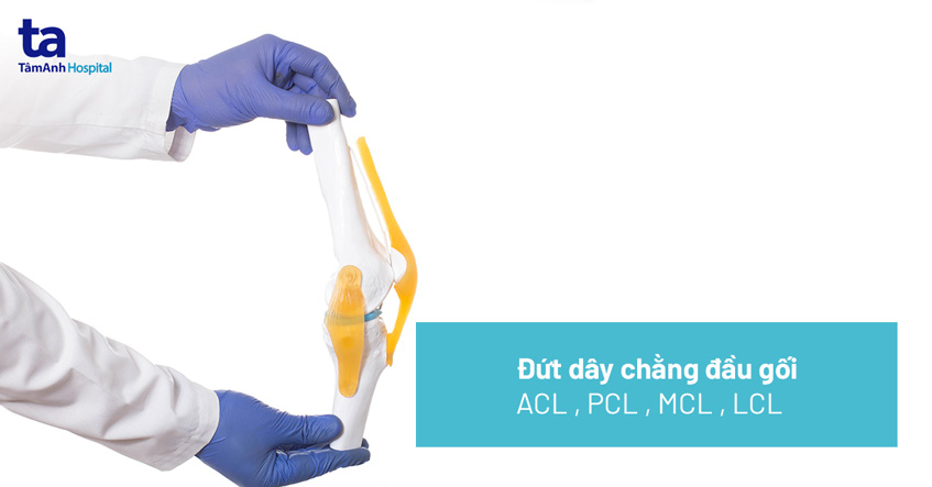 Đứt dây chằng đầu gối: Nguyên nhân, dấu hiệu và cách điều trị
