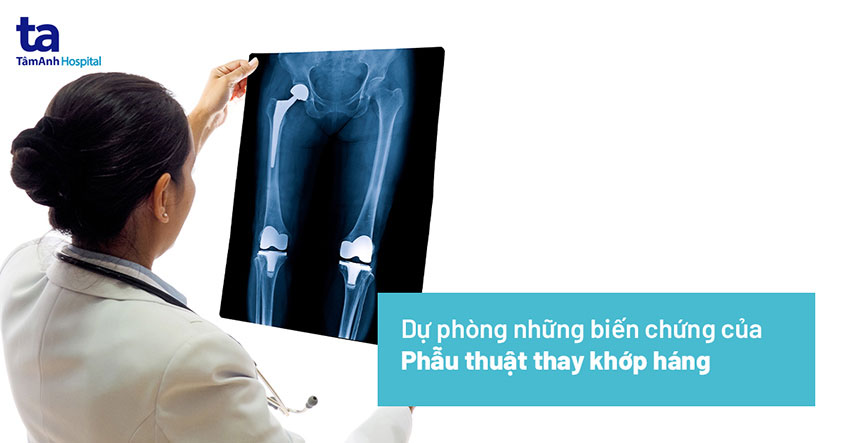 Biến chứng sau phẫu thuật thay khớp háng