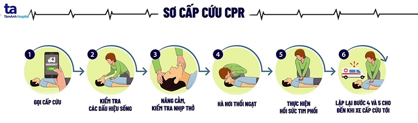 Sơ cứu trẻ bị điện giật