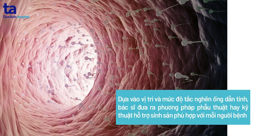Tắc ống dẫn tinh: Nguyên nhân, chẩn đoán và cách điều trị