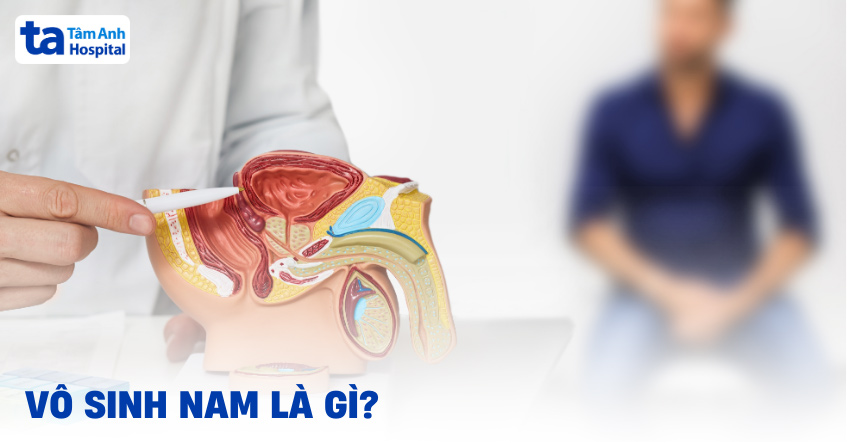 Vô sinh nam là gì?